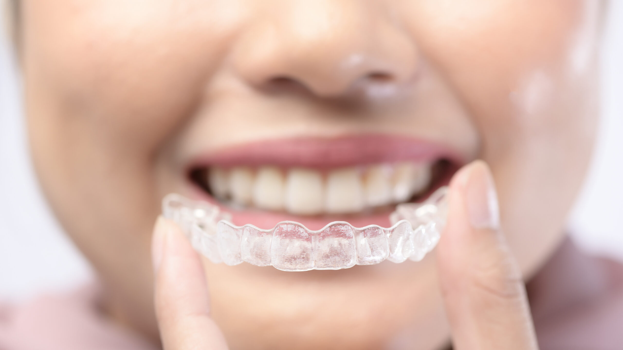 Clear Aligners