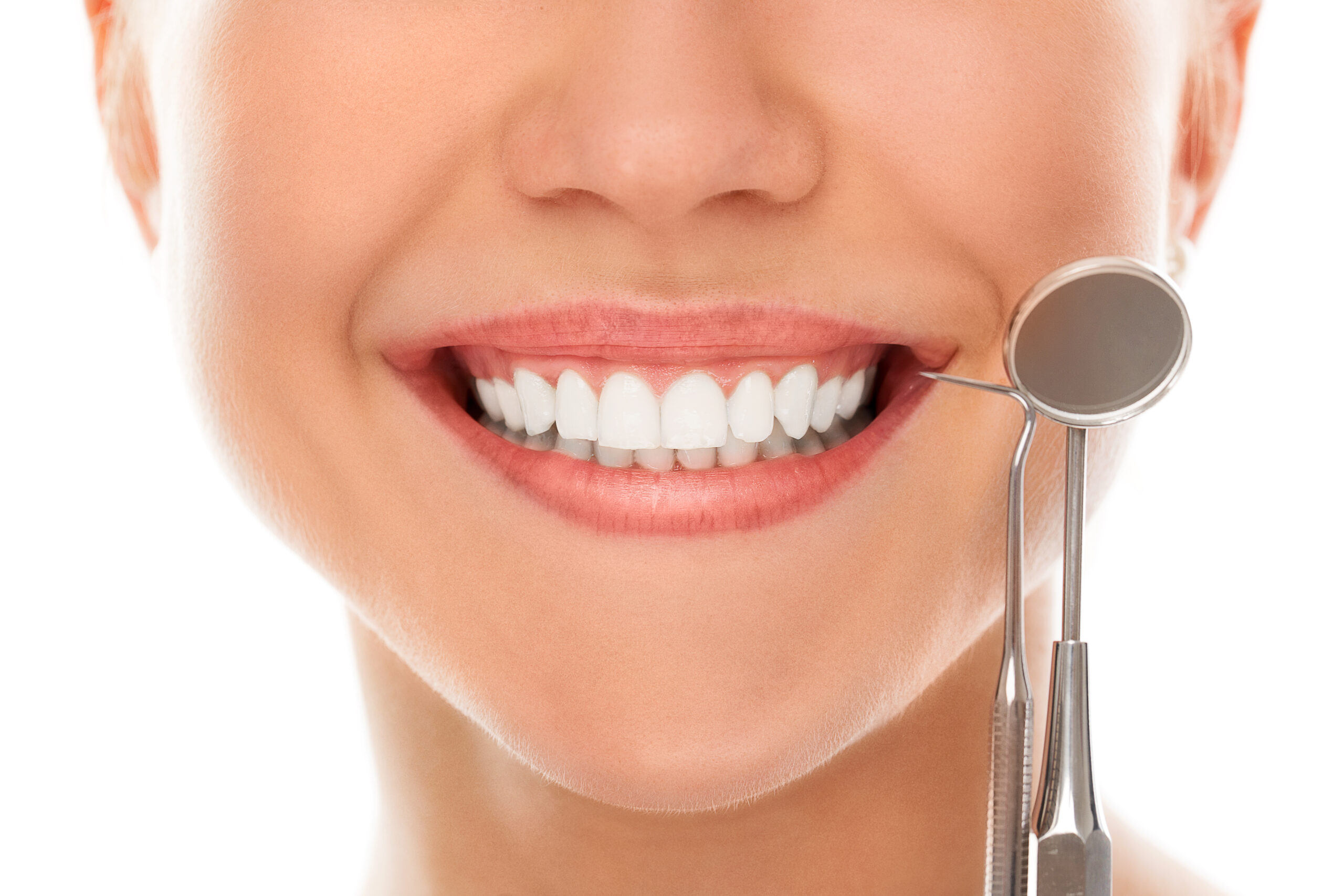 Veneers