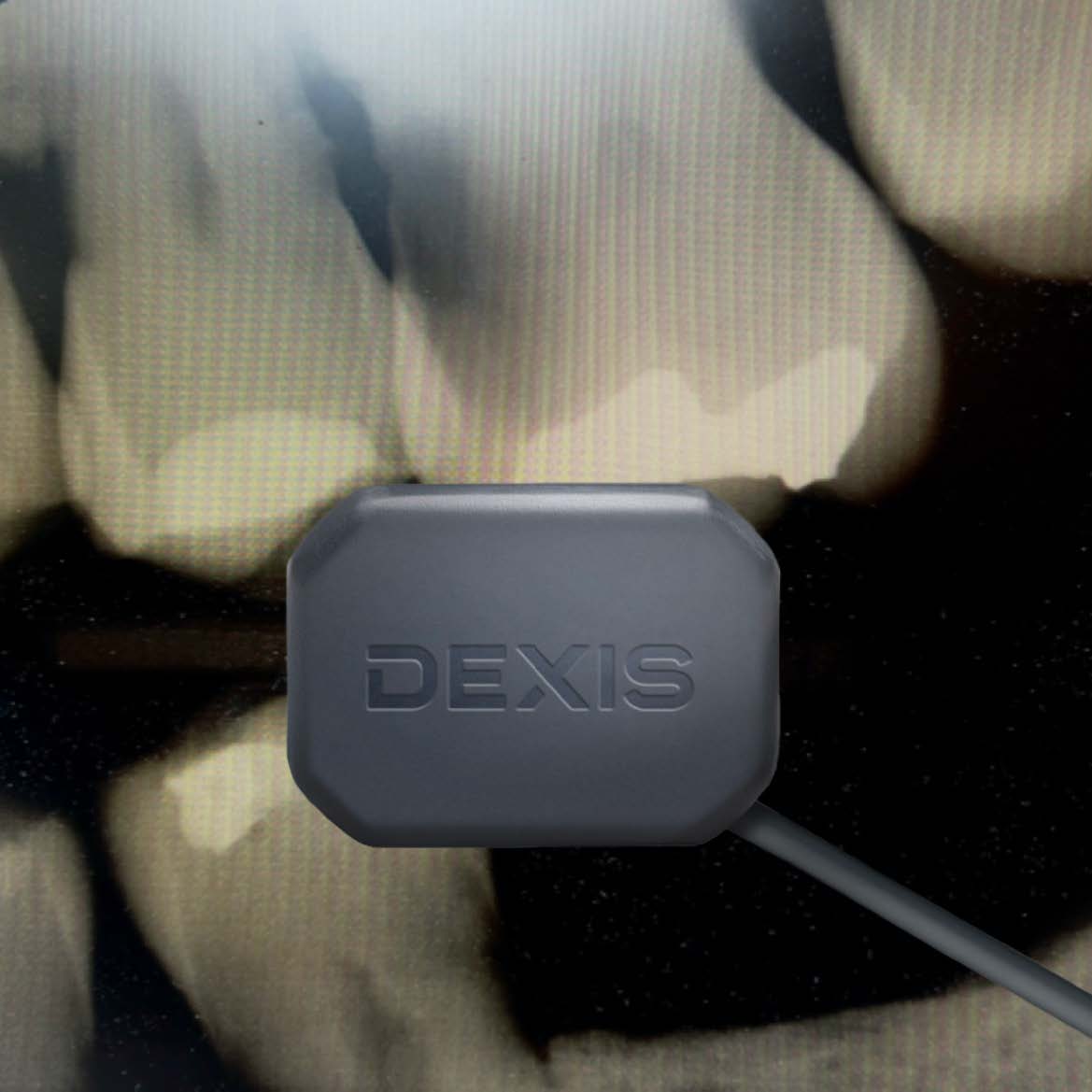 Digital X-rays